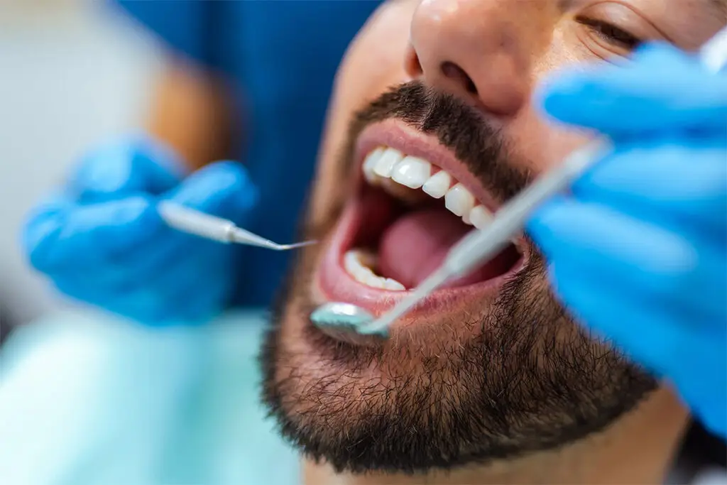 Dry Mouth in Lowell: Why Saliva Matters for Your Teeth and Gums